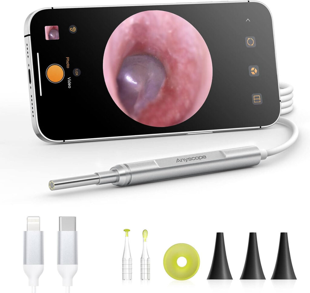 Android Scope Camera Best Digital Otoscopes in 2026 – Cameras, WiFi & Smartphone Models