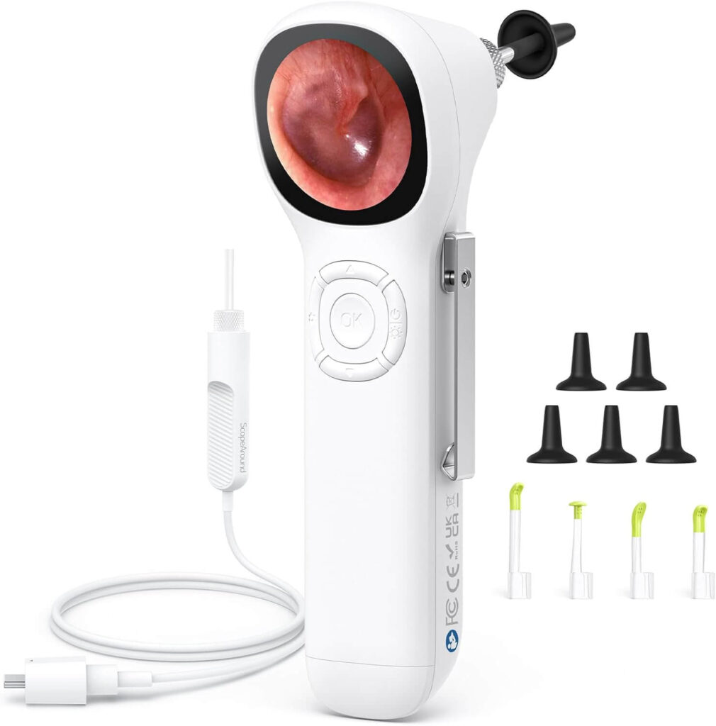 ScopeAround Digital Otoscope wIPS Screen, 720p HD Smart Video Otoscope