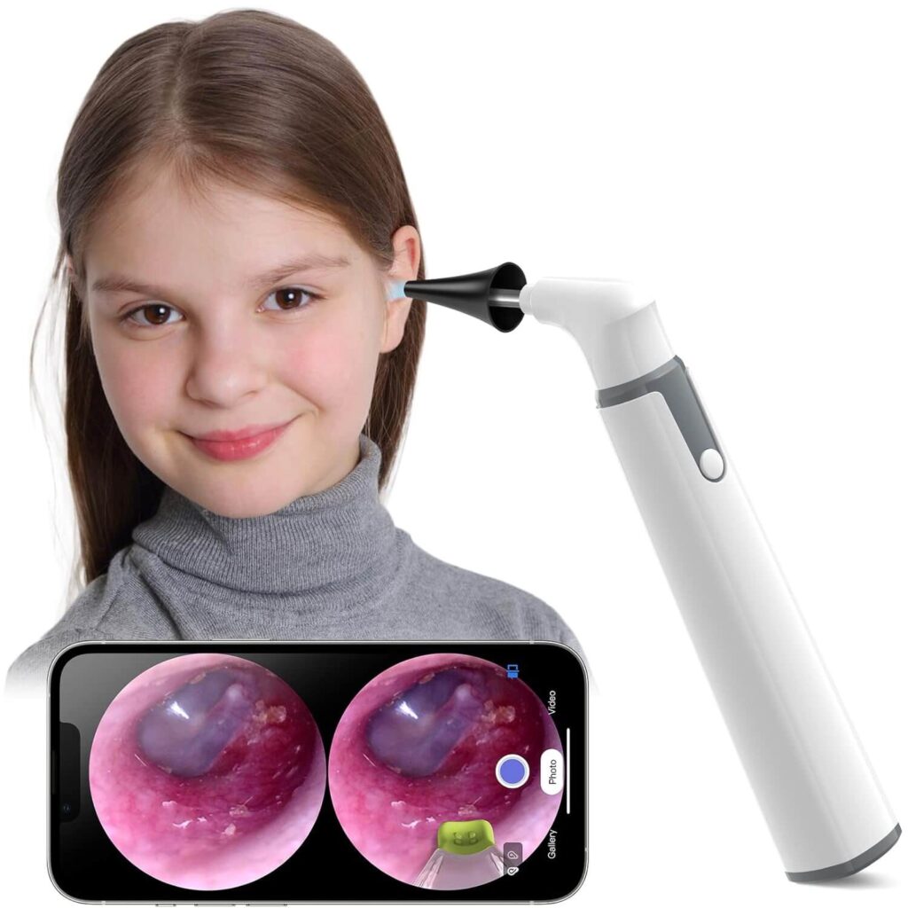 ScopeAround Wireless Digital Otoscope (720p)