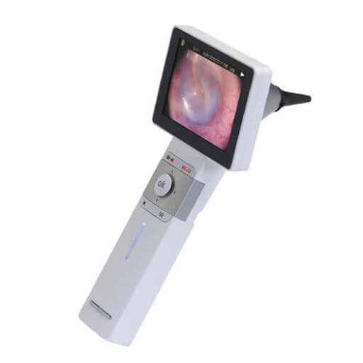 otoscope